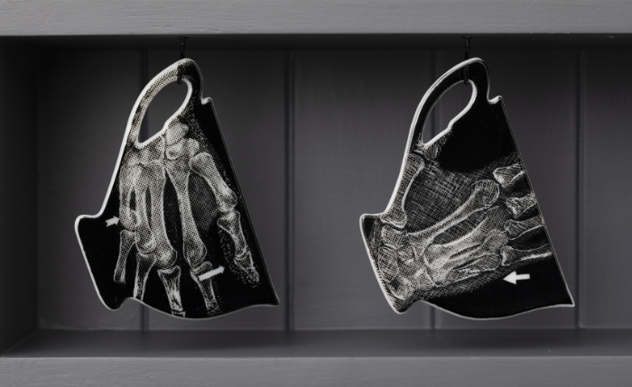 Linda Norris’s screenprinted and painted flat glass cups showing x-rays of intimate partner violence, part of 'Broken Home' (2024). 